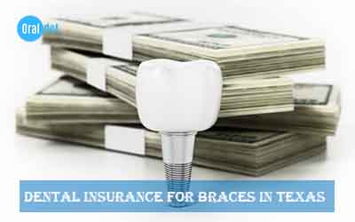 Dental Insurance For Braces In Texas